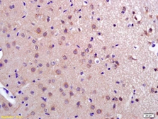 Anti-PDCD10 antibody used in IHC (Paraffin sections) (IHC-P). GTX51761