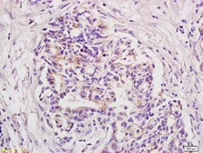 Anti-BOD1 antibody used in IHC (Paraffin sections) (IHC-P). GTX51766