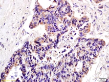 Anti-XAGE2 antibody used in IHC (Paraffin sections) (IHC-P). GTX51780