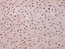 Anti-TSPYL5 antibody used in IHC (Paraffin sections) (IHC-P). GTX51813
