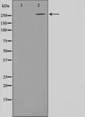 Anti-Acetyl-CoA Carboxylase 1 (phospho Ser80) antibody used in Western Blot (WB). GTX52340