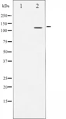 Anti-NFAT4 antibody used in Western Blot (WB). GTX52371