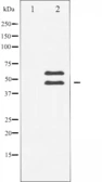 Anti-CaMK2 beta/ gamma/ delta antibody used in Western Blot (WB). GTX52374