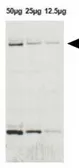 Anti-LRRK2 antibody used in Western Blot (WB). GTX52385