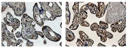 Anti-PLGF antibody [2D93] used in IHC (Paraffin sections) (IHC-P). GTX52463
