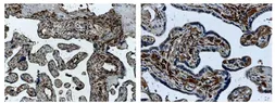 Anti-ACVRL1 antibody [8G33] used in IHC (Paraffin sections) (IHC-P). GTX52468