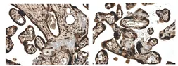 Anti-Activin Receptor Type IA antibody [9J17] used in IHC (Paraffin sections) (IHC-P). GTX52503