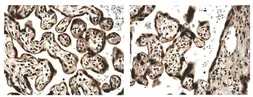 Anti-Activin Receptor Type IIA antibody [6J16] used in IHC (Paraffin sections) (IHC-P). GTX52509