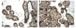 Anti-BMPR2 antibody [9A10] used in IHC (Paraffin sections) (IHC-P). GTX52511