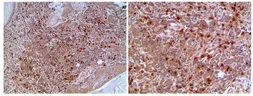 Anti-CD8 alpha antibody [MAB0708] used in IHC (Paraffin sections) (IHC-P). GTX53126