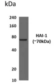 Anti-HAI-1 antibody [3G21] used in Western Blot (WB). GTX53177