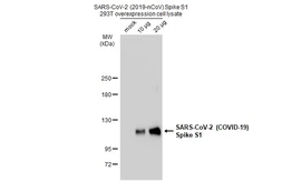 SARS-CoV-2 (COVID-19) Spike S1 overexpression 293T whole cell lysate. GTX535663