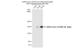 SARS-CoV-2 (COVID-19) Spike overexpression 293T whole cell lysate. GTX535664