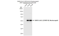 SARS-CoV-2 (COVID-19) Nucleocapsid overexpression 293T whole cell lysate. GTX535665