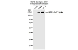 MERS-CoV Spike overexpression 293T whole cell lysate. GTX535667