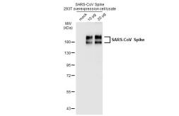 SARS-CoV Spike overexpression 293T whole cell lysate. GTX535668