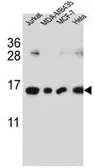 Anti-H2AFJ antibody used in Western Blot (WB). GTX53601