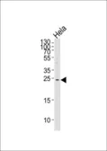 Anti-HCCA2 antibody used in Western Blot (WB). GTX53605