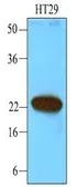 Anti-CIB1 antibody [1D1] used in Western Blot (WB). GTX53699