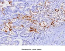 Anti-L-FABP antibody [2G4] used in IHC (Paraffin sections) (IHC-P). GTX53712