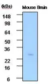 Anti-PSPH antibody [3G12] used in Western Blot (WB). GTX53773