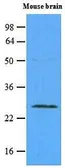 Anti-RAB5A antibody [3A4] used in Western Blot (WB). GTX53775