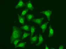 Anti-CDC5L antibody used in Immunocytochemistry/ Immunofluorescence (ICC/IF). GTX53960