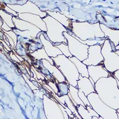 Anti-FABP4 antibody used in IHC (Paraffin sections) (IHC-P). GTX54016