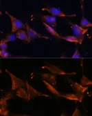Anti-Fibrinogen gamma antibody used in Immunocytochemistry/ Immunofluorescence (ICC/IF). GTX54026