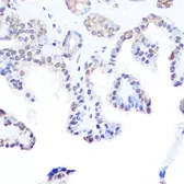 Anti-DDX3 antibody used in IHC (Paraffin sections) (IHC-P). GTX54030