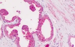Anti-CD11c antibody used in IHC (Paraffin sections) (IHC-P). GTX54062