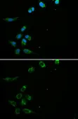 Anti-HFE antibody used in Immunocytochemistry/ Immunofluorescence (ICC/IF). GTX54085