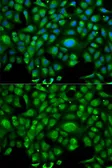 Anti-HSP70 1L antibody used in Immunocytochemistry/ Immunofluorescence (ICC/IF). GTX54093