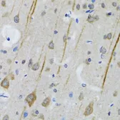 Anti-5-HT3A receptor antibody used in IHC (Paraffin sections) (IHC-P). GTX54151