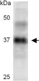Anti-Casp3b antibody used in Western Blot (WB). GTX54181