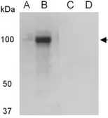 Anti-Rb1 antibody used in Western Blot (WB). GTX54191