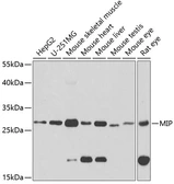 Anti-Aquaporin 0 antibody used in Western Blot (WB). GTX54297
