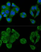 Anti-IRF3 antibody used in Immunocytochemistry/ Immunofluorescence (ICC/IF). GTX54366