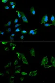 Anti-NEK8 antibody used in Immunocytochemistry/ Immunofluorescence (ICC/IF). GTX54586
