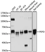 Anti-PEPD antibody used in Western Blot (WB). GTX54636