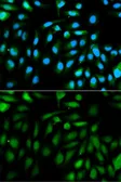 Anti-Park7 / DJ-1 antibody used in Immunocytochemistry/ Immunofluorescence (ICC/IF). GTX54642
