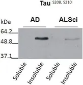 Anti-Tau (phospho Ser208/210) antibody used in Western Blot (WB). GTX54656