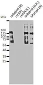 Anti-Robo4 antibody used in Western Blot (WB). GTX54660
