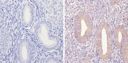 Anti-eIF2B3 antibody [1H3] used in IHC (Paraffin sections) (IHC-P). GTX54741