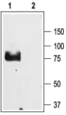 Anti-ENaC Gamma antibody used in Western Blot (WB). GTX54801
