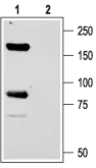 Anti-ASIC1 antibody used in Western Blot (WB). GTX54804