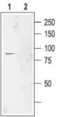 Anti-CLCN2 antibody used in Western Blot (WB). GTX54814