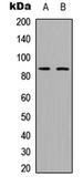 Anti-ADAM28 antibody used in Western Blot (WB). GTX54933