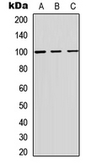 Anti-ADAM12 antibody used in Western Blot (WB). GTX54939