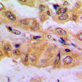Anti-SMAD2 (phospho Ser467) antibody used in IHC (Paraffin sections) (IHC-P). GTX54987